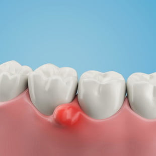 Common Emergency Treatments We Offer