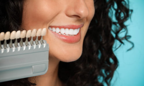 Patient selecting tooth shade during porcelain veneers consultation in Mississauga dental clinic.