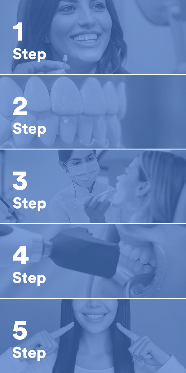 teeth-whitening-steps