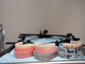The Benefits of All-on-4 Dental Implants Versus Traditional Dentures
