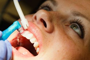 Why Is It Important To Get Teeth Cleaned?