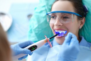 Dental Bonding in Mississauga – Fast, Affordable Smile Fix