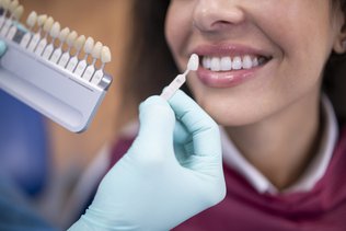 Best Dentist for Veneers: Your Guide to a Perfect Smile