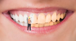 What is the Difference Between Teeth Whitening and Dental Cleaning?