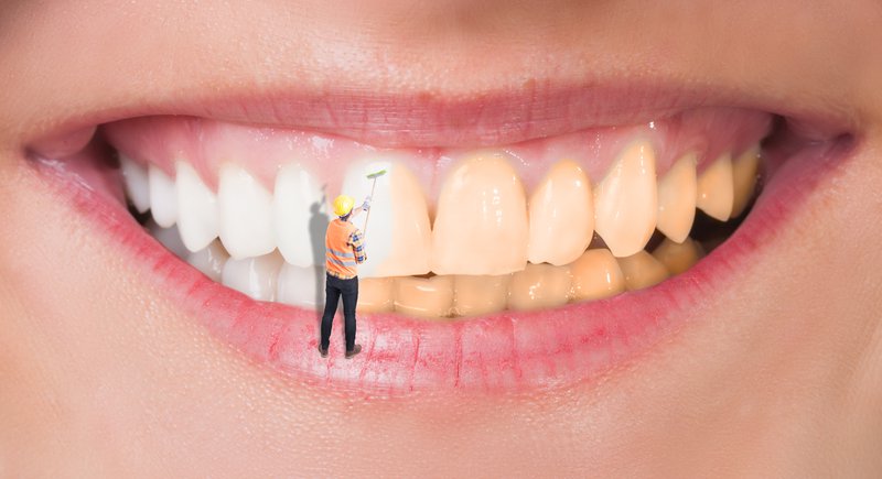 what-is-the-difference-between-teeth-whitening-and-dental-cleaning